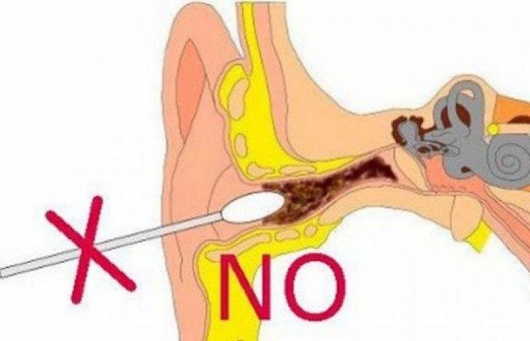 Как правильно чистить уши в домашних условиях, чтобы не повредить ушную раковину