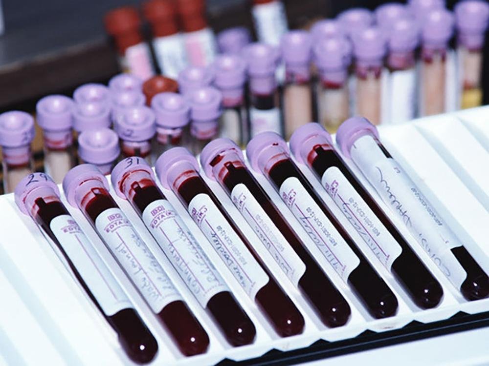 Как с помощью анализа крови выявить неполадки в организме