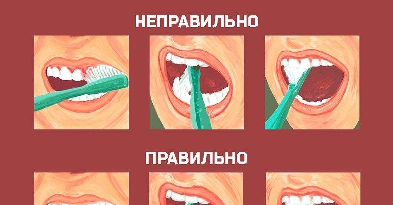 Всю жизнь ты чистил зубы неправильно! Благодаря этой схеме всё меняется…